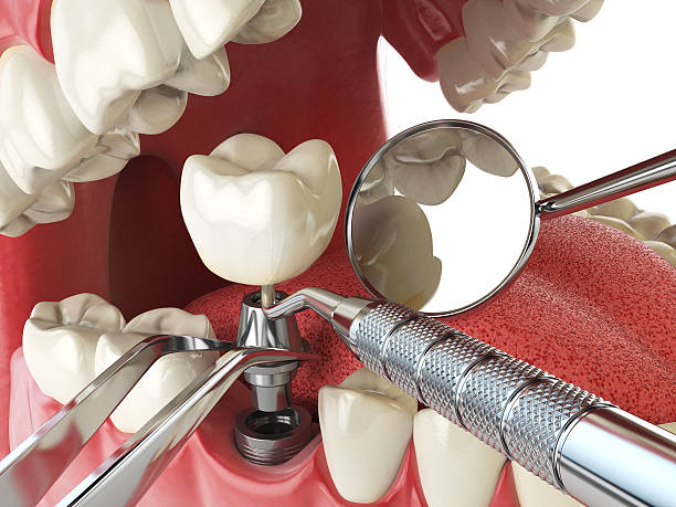 Best Emergency Dental Care for Broken or Chipped Teeth in Rising Sun Lebanon, DE